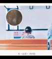 308激光治疗影响怀孕吗为什么