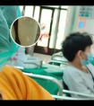 308激光治疗后多久用他克莫司软膏