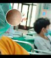 治疗白癜风的308激光多少钱一个