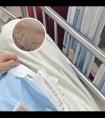 他克莫司去软膏